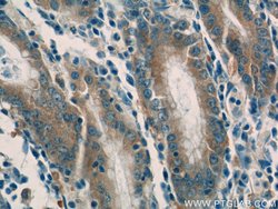 SNAP29 Rabbit anti-Human, Mouse, Rat, Polyclonal, Proteintech:Antibodies:Primary
