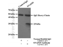 SNAP29 Rabbit anti-Human, Mouse, Rat, Polyclonal, Proteintech:Antibodies:Primary
