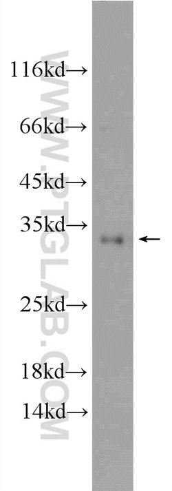 SNAP29 Rabbit anti-Human, Mouse, Rat, Polyclonal, Proteintech:Antibodies:Primary