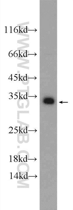 SNAP29 Rabbit anti-Human, Mouse, Rat, Polyclonal, Proteintech:Antibodies:Primary