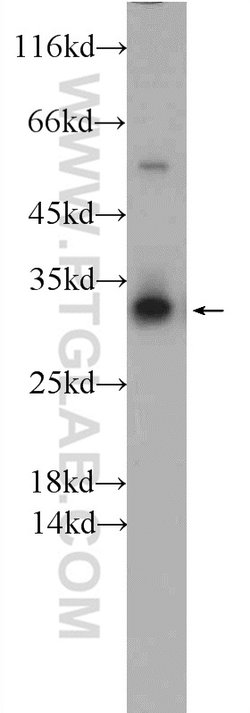 SNAP29 Rabbit anti-Human, Mouse, Rat, Polyclonal, Proteintech:Antibodies:Primary