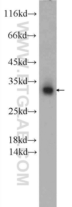 SNAP29 Rabbit anti-Human, Mouse, Rat, Polyclonal, Proteintech:Antibodies:Primary