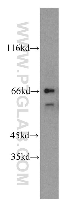 QSOX1 Rabbit anti-Human, Mouse, Rat, Polyclonal, Proteintech 150 &mu;L;
