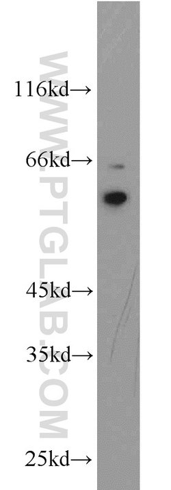 QSOX1 Rabbit anti-Human, Mouse, Rat, Polyclonal, Proteintech 150 &mu;L;