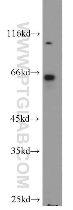 QSOX1 Rabbit anti-Human, Mouse, Rat, Polyclonal, Proteintech 150 &mu;L;