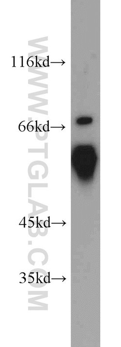 QSOX1 Rabbit anti-Human, Mouse, Rat, Polyclonal, Proteintech 150 &mu;L;