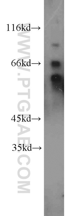QSOX1 Rabbit anti-Human, Mouse, Rat, Polyclonal, Proteintech 150 &mu;L;