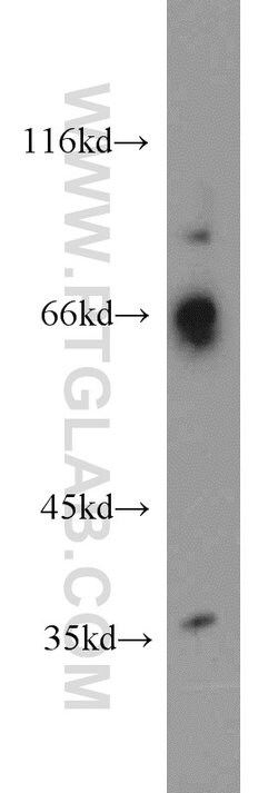 QSOX1 Rabbit anti-Human, Mouse, Rat, Polyclonal, Proteintech 150 &mu;L;