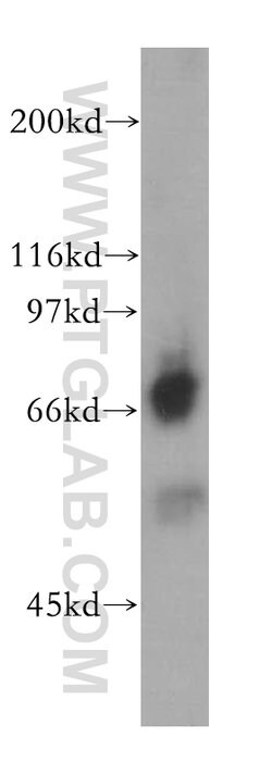 QSOX1 Rabbit anti-Human, Mouse, Rat, Polyclonal, Proteintech 150 &mu;L;