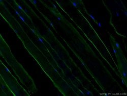 Dystrophin Rabbit anti-Human, Mouse, Rat, Polyclonal, Proteintech:Antikörper:Primärantikörper