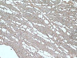 Dystrophin Rabbit anti-Human, Mouse, Rat, Polyclonal, Proteintech:Antikörper:Primärantikörper