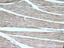 Dystrophin Rabbit anti-Human, Mouse, Rat, Polyclonal, Proteintech:Antikörper:Primärantikörper