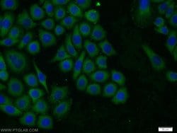 TROVE2 Rabbit anti-Human, Mouse, Rat, Polyclonal, Proteintech 150 &mu;L;
