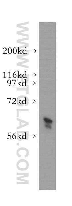 TROVE2 Rabbit anti-Human, Mouse, Rat, Polyclonal, Proteintech 150 &mu;L;