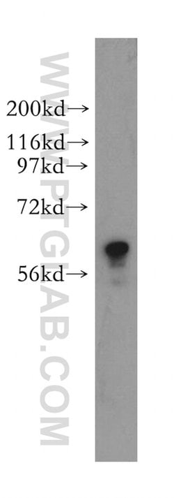 TROVE2 Rabbit anti-Human, Mouse, Rat, Polyclonal, Proteintech 150 &mu;L;