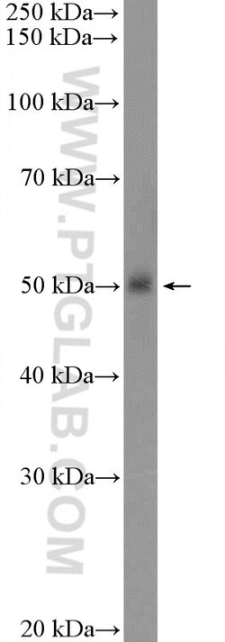 TROVE2 Rabbit anti-Human, Mouse, Rat, Polyclonal, Proteintech 150 &mu;L;