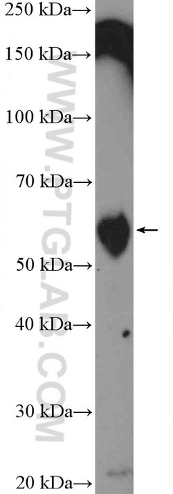 TROVE2 Rabbit anti-Human, Mouse, Rat, Polyclonal, Proteintech 150 &mu;L;