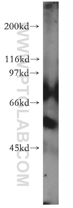 RabGEF1 Rabbit anti-Human, Mouse, Rat, Polyclonal, Proteintech 150 &mu;L | Buy Online | Proteintech Group Inc | Fisher Scientific