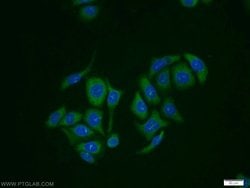 RabGEF1 Rabbit anti-Human, Mouse, Rat, Polyclonal, Proteintech 150 &mu;L | Buy Online | Proteintech Group Inc | Fisher Scientific