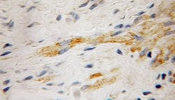 RabGEF1 Rabbit anti-Human, Mouse, Rat, Polyclonal, Proteintech 150 &mu;L | Buy Online | Proteintech Group Inc | Fisher Scientific