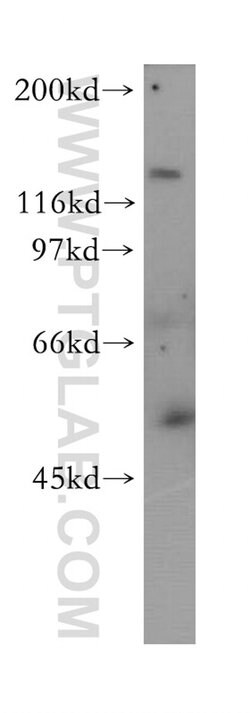 RabGEF1 Rabbit anti-Human, Mouse, Rat, Polyclonal, Proteintech 150 &mu;L | Buy Online | Proteintech Group Inc | Fisher Scientific