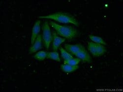 ADAMTS1 Rabbit anti-Human, Mouse, Rat, Polyclonal, Proteintech:Antibodies:Primary