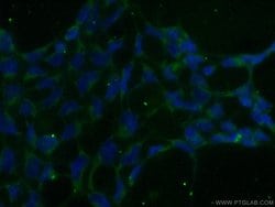 ADAMTS1 Rabbit anti-Human, Mouse, Rat, Polyclonal, Proteintech:Antibodies:Primary