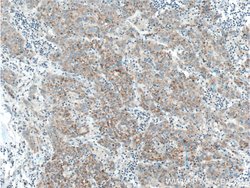 ADAMTS1 Rabbit anti-Human, Mouse, Rat, Polyclonal, Proteintech:Antibodies:Primary
