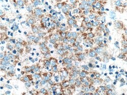 ADAMTS1 Rabbit anti-Human, Mouse, Rat, Polyclonal, Proteintech:Antibodies:Primary