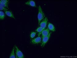 SEC5/EXOC2 Rabbit anti-Human, Mouse, Rat, Polyclonal, Proteintech:Antibodies:Primary
