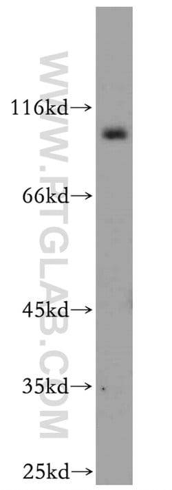 SEC5/EXOC2 Rabbit anti-Human, Mouse, Rat, Polyclonal, Proteintech:Antibodies:Primary