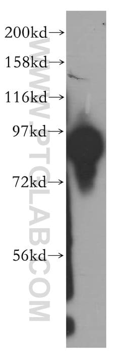 SEC5/EXOC2 Rabbit anti-Human, Mouse, Rat, Polyclonal, Proteintech:Antibodies:Primary