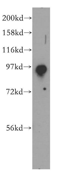 SEC5/EXOC2 Rabbit anti-Human, Mouse, Rat, Polyclonal, Proteintech:Antibodies:Primary