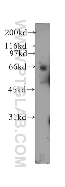 PDE12 Rabbit anti-Human, Mouse, Rat, Polyclonal, Proteintech 150 &mu;L;