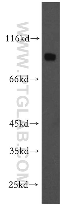 DNAI1 Rabbit anti-Human, Mouse, Rat, Polyclonal, Proteintech 150 &mu;L;