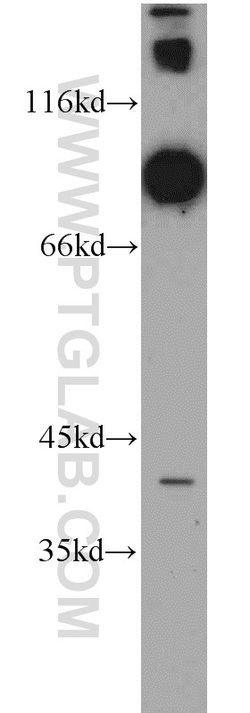 DNAI1 Rabbit anti-Human, Mouse, Rat, Polyclonal, Proteintech 150 &mu;L;