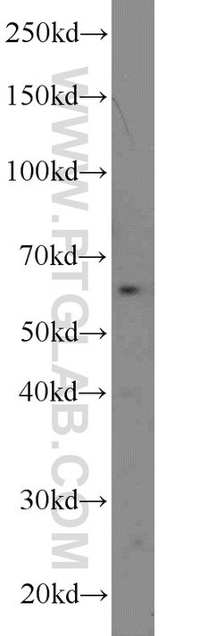 RTKN Rabbit anti-Human, Mouse, Rat, Polyclonal, Proteintech 150 &mu;L;