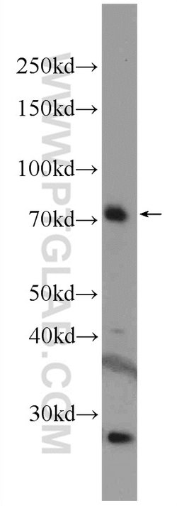 RTKN Rabbit anti-Human, Mouse, Rat, Polyclonal, Proteintech 150 &mu;L;