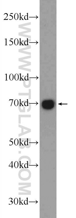 RTKN Rabbit anti-Human, Mouse, Rat, Polyclonal, Proteintech 150 &mu;L;