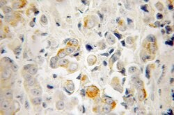 RTKN Rabbit anti-Human, Mouse, Rat, Polyclonal, Proteintech 150 &mu;L;