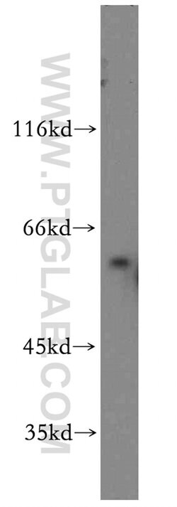 RTKN Rabbit anti-Human, Mouse, Rat, Polyclonal, Proteintech 150 &mu;L;