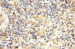 CBLB Rabbit anti-Human, Mouse, Rat, Polyclonal, Proteintech 20 &mu;L; Unconjugated:Anticuerpos