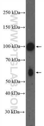 Thumbnail_PRKD3 Rabbit anti-Human, Mouse, Rat, Polyclonal, Proteintech:Antibodies:Primary