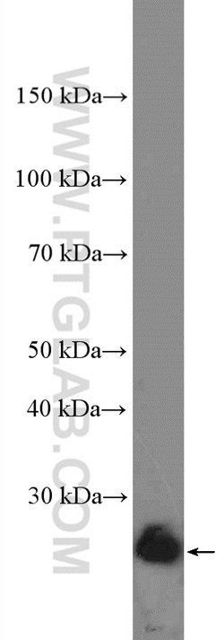 BCL2 Rabbit anti-Human, Polyclonal, Proteintech:Antibodies:Primary Antibodies