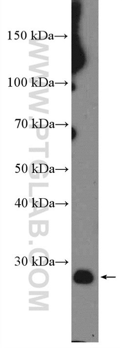 BCL2 Rabbit anti-Human, Polyclonal, Proteintech:Antibodies:Primary Antibodies