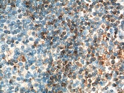 BCL2 Rabbit anti-Human, Polyclonal, Proteintech:Antibodies:Primary Antibodies