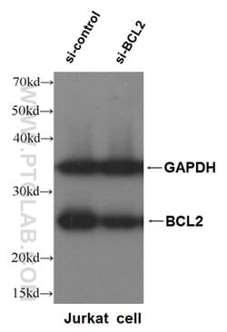 BCL2 Rabbit anti-Human, Polyclonal, Proteintech:Antibodies:Primary Antibodies