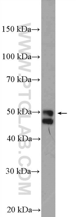 SRFBP1 Rabbit anti-Human, Mouse, Polyclonal, Proteintech:Antibodies:Primary