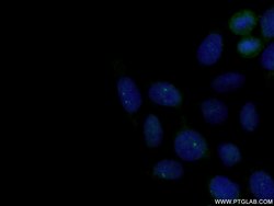Centrin 1 Rabbit anti-Human, Polyclonal, Proteintech 150 &mu;L; Unconjugated:Antibodies,