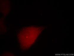 Centrin 1 Rabbit anti-Human, Polyclonal, Proteintech 150 &mu;L; Unconjugated:Antibodies,